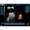 MSLCU18-2015 Nouvelle et meilleure machine à ultrasons portable 3D et 4D utilisée en humain et en vétérinaire